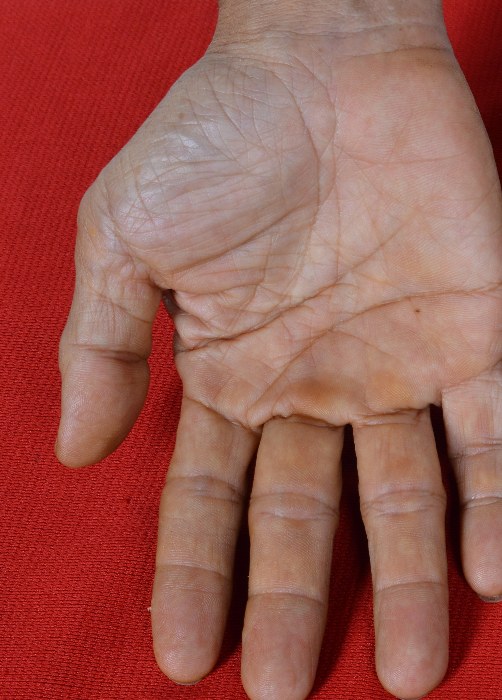 Example of a good palm photo: flat hand, fingers spread, palm facing the camera, filling the frame